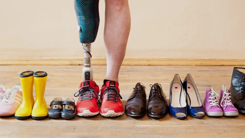 In einem Paar roter Turnschuhe steckt ein Bein und eine Beinprothese. Daneben stehen viele andere Schuhe in verschiedenen Größen und Formen.